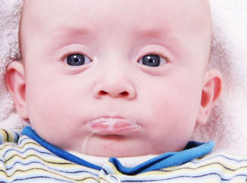 Ba mẹ cần làm gì khi trẻ sơ sinh bị nôn trớ sữa?