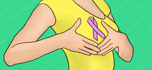 Ung thư vú – Ung thư gây tử vong ở phụ nữ hàng đầu thế giới
