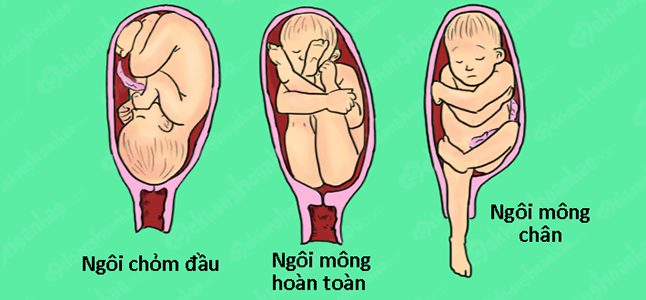 Tìm hiểu về ngôi thai