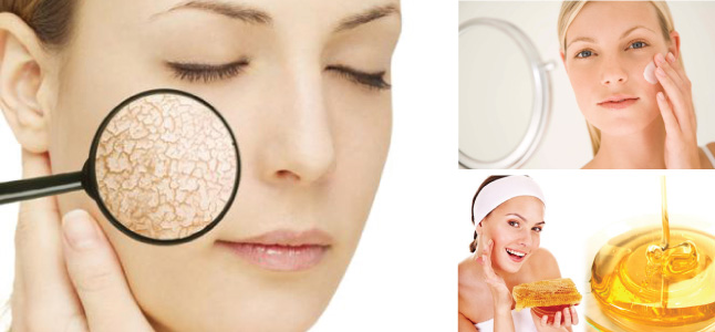Hiểu về da khô và cách chăm sóc da khô hiệu quả